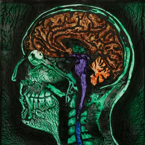 Detailed cross-section painting of human skull and brain in green tones with colorful neural pathways